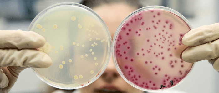 Petri Dishes
